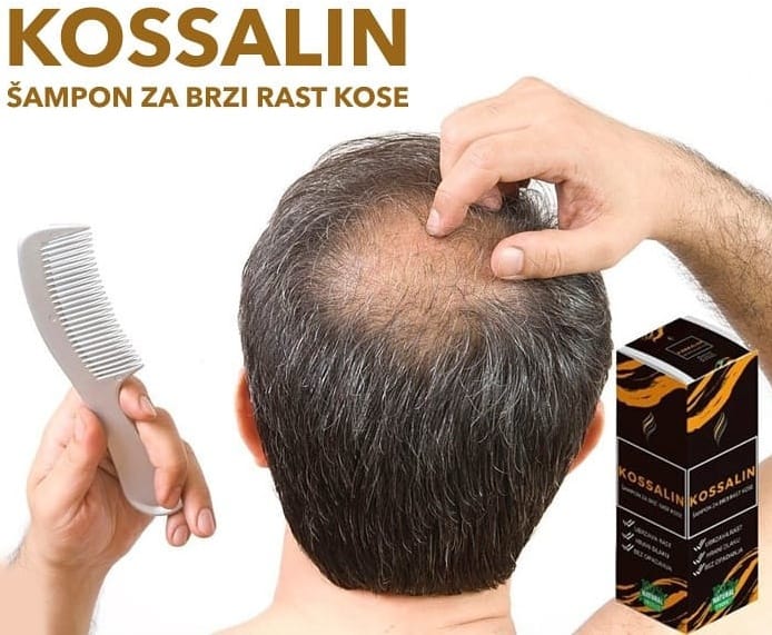 Kossalin Šampon Protiv Ćelavosti